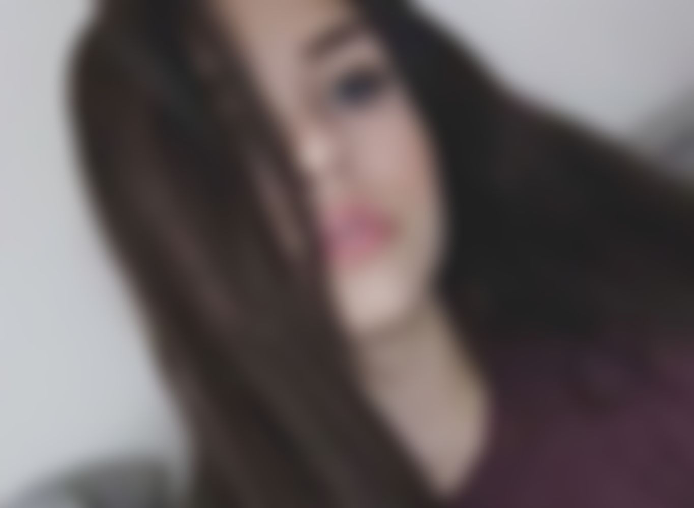 albina